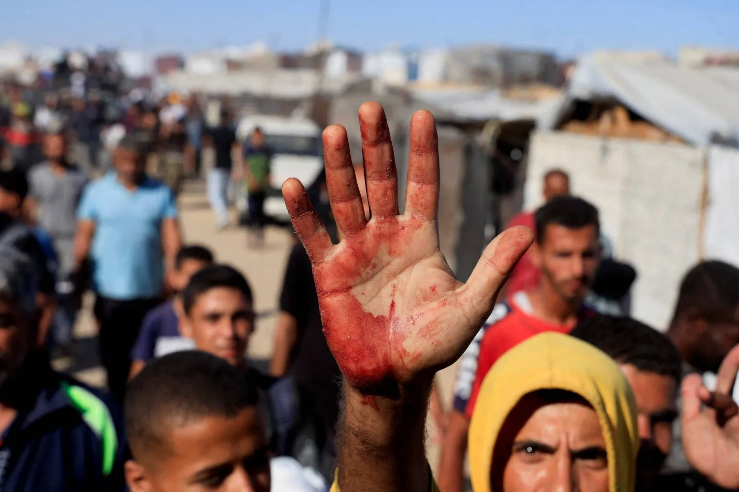 Medical need in Gaza